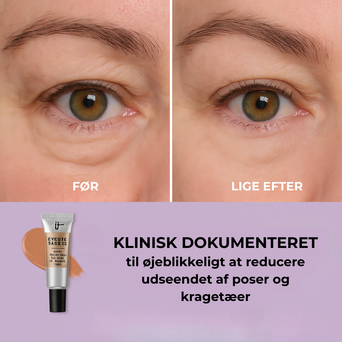 ØjenLys™ Øjeblikkelig Udglatter til Øjenomgivelserne