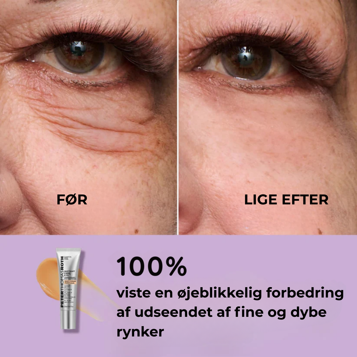 ØjenLys™ Øjeblikkelig Udglatter til Øjenomgivelserne