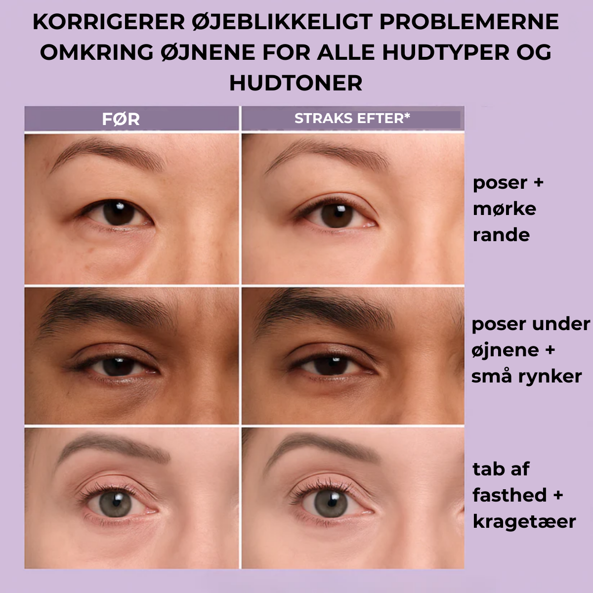 ØjenLys™ Øjeblikkelig Udglatter til Øjenomgivelserne